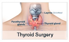 Thyroid Surgery