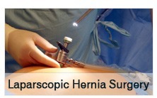 Laparoscopic Hernia Surgery