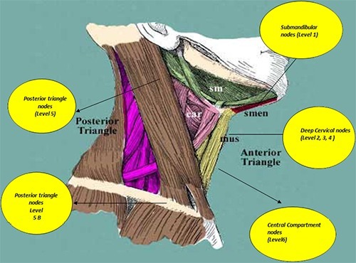 Block dissection of neck node