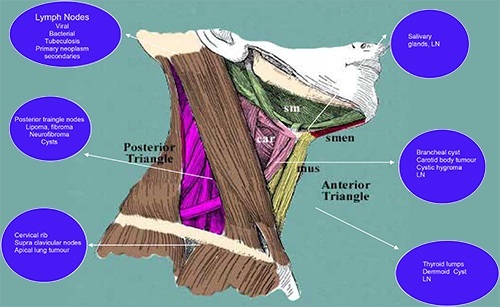 other Neck Lumps